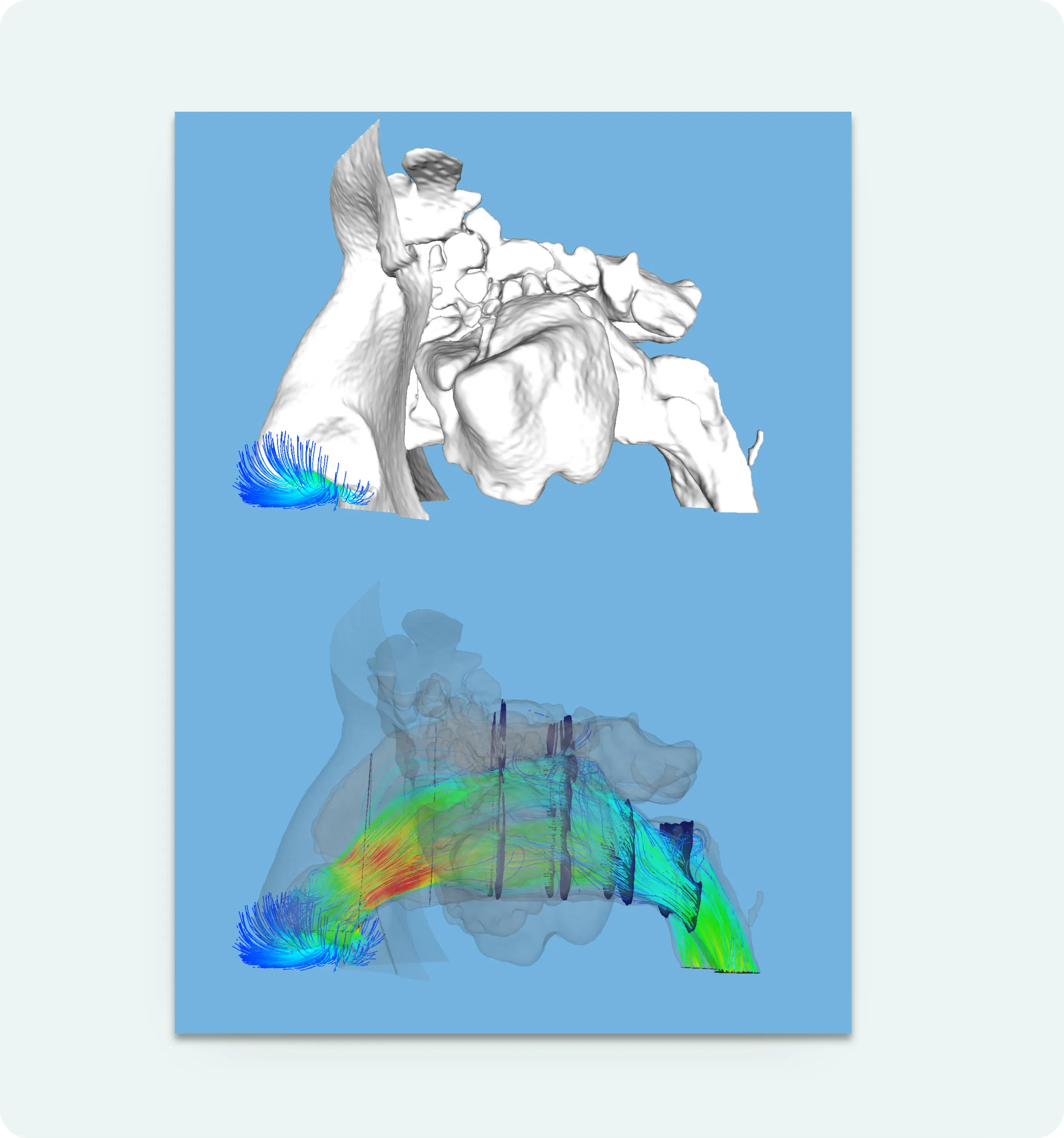 3D visualization in Flowgy for medical research.